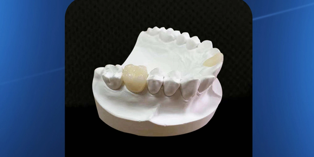 PMMA Dental Zirconia Blocks, CAD Dental Zirconium Blocks, Cam Dental Zirconia Disc for Dental Milling Machine